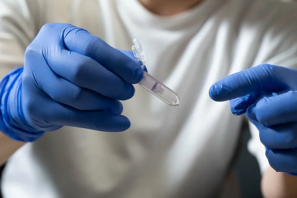 国内の遺跡から収集したヒトの側頭骨から採取した微量試料を試薬に浸し、DNAを抽出する工程。抽出した試料は検査機関でDNA塩基配列の解析が行われる