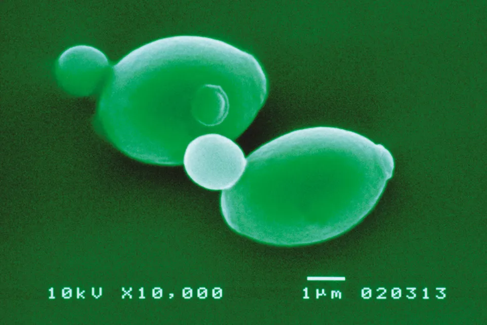 「いいちこ酵母」の電子顕微鏡写真