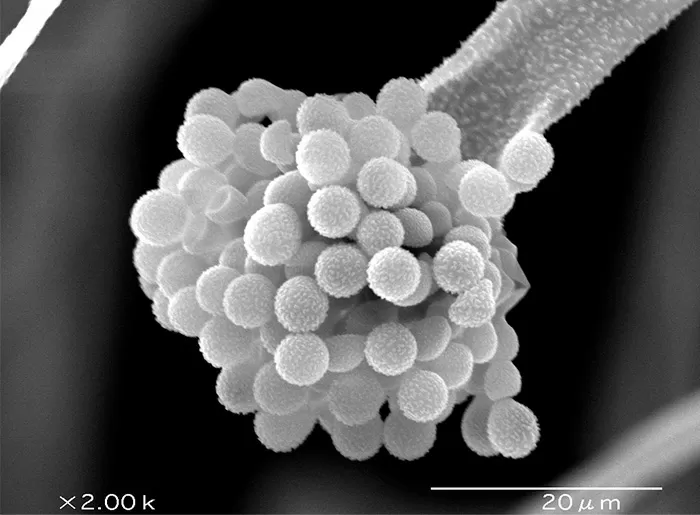 発酵食品をつくる際に大活躍する「麹菌」の顕微鏡写真（写真提供：独立行政法人酒類総合研究所）