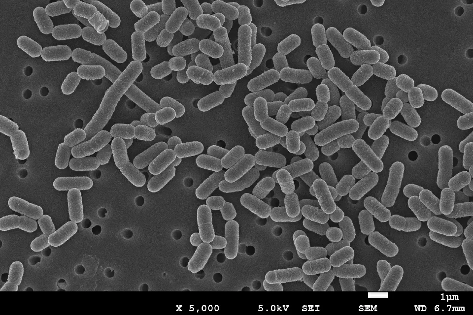 「細菌」に分類される「乳酸菌」。サイズは1～2μm程度（写真提供：独立行政法人酒類総合研究所）