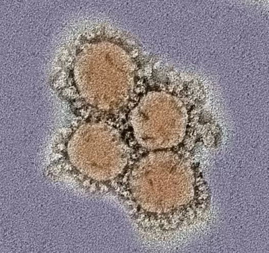 新型コロナウイルスの電子顕微鏡写真。サイズは0.05μm程度（撮影：東京大学医科学研究所 今井正樹客員教授・氏江美智子博士）